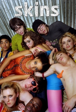 Skins-watch